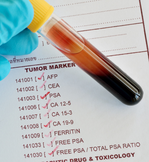 Quais os exames laboratoriais para checar a saúde da tireóide?