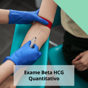 Exame Beta HCG Quantitativo em até 2 dias úteis